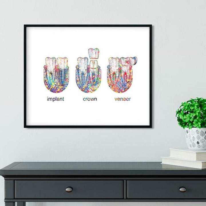 Cosmetic Dentistry Poster | Implant Crown Poster |  Fit For Icons