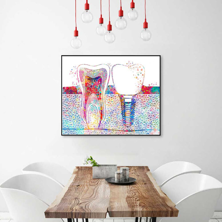 Tooth Implant Poster - Tooth Implant Wall Art Poster - Fir For Icons