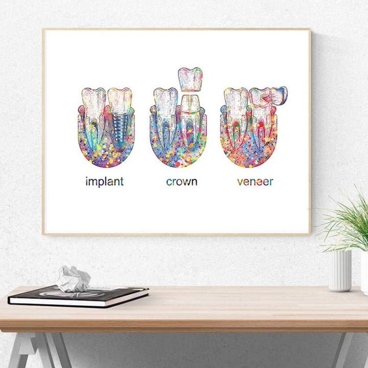 Cosmetic Dentistry Poster | Implant Crown Poster |  Fit For Icons